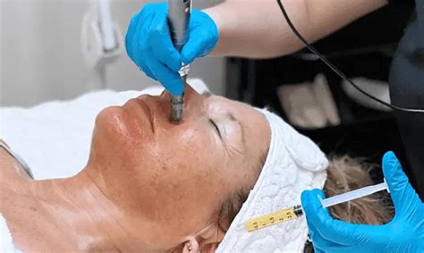 emsculpt temecula, ca|Lilly beauty spa network.